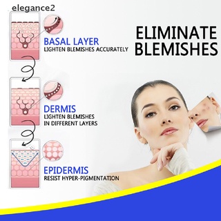 [elegance2] pro.w crema de manchas anti acné cicatrices manchas oscuras eliminación de la piel blanqueamiento 30 ml [elegance2] (4)