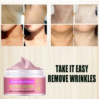 【Chiron】Effective Cream For Deep Moisturizing And Anti-wrinkle Skin Care Remove Wrinkles (1)
