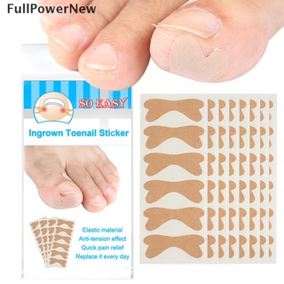 (Fu*Caliente) calcomanías correctoras de uñas encarnadas/Corrector de uñas/tratamiento paroniquia {PowerNew}