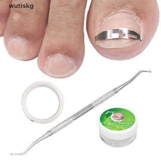 wutiskg dedo del pie encarnado dedo del pie recuperar corrección parche pedicura uñas fijador cuidado de pies herramienta co