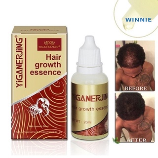 [winnie] esencia unisex de crecimiento del cabello anti pérdida tratamiento del cuero cabelludo control de aceite cuidado de la salud (3)