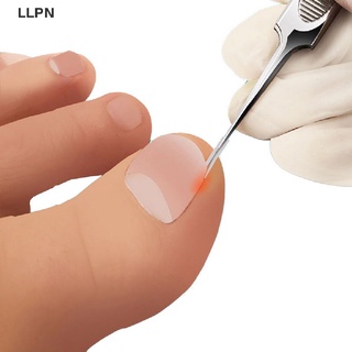 [LLPN] 50pcs Ingrown Pads Foot Nail Pedicure Tool Paronychia Treatments Foot Care [Hot New]