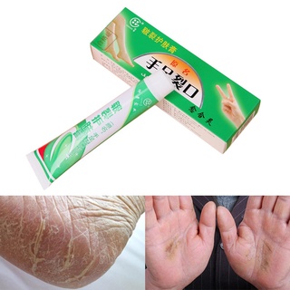 atlantamart mano pie crema de grietas talón agrietado peeling anti-seco crema de reparación de grietas cuidado de la piel (1)