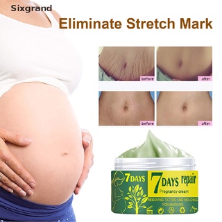 [sixgrand] crema suave para reparación de la piel de maternidad para estrías/cuidado de eliminación de cicatrices co (1)