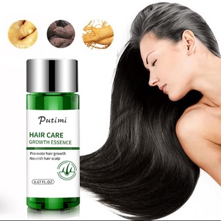 atlantamart 20ml esencia de crecimiento del cabello hidratante anti pérdida del cuero cabelludo tratamiento aceite esencial