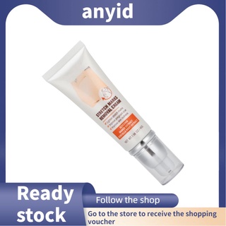 Anyid AUQUEST Stretch Mark Scar Removal Cream Maternity Repair Treatment 45g