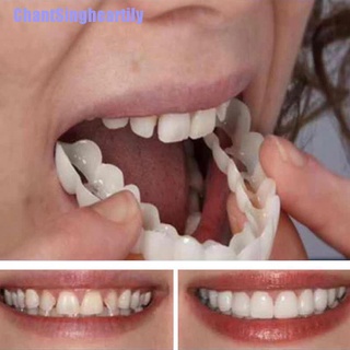 [CHMY]-3X odontología cosmética instantánea perfecta sonrisa comodidad ajuste Flex dientes chapa