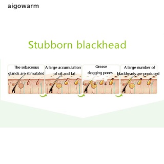 aigowarm blackhead removal carbón de bambú peel off máscara para reducir la piel de poros acné co (4)