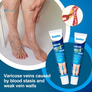 stock 20g varicosa vena crema fácil de absorber reparación hinchazón vasculitis sintética vaso sanguíneo ungüento para adultos