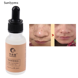[sxm] crema reparadora de nevus/reparación natural/suero purificador de manchas de piel orgánica uyk