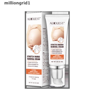 【milliongrid1】 AUQUEST Remove Pregnancy Scars Acne Cream Stretch Treatment Maternity Repair Hot