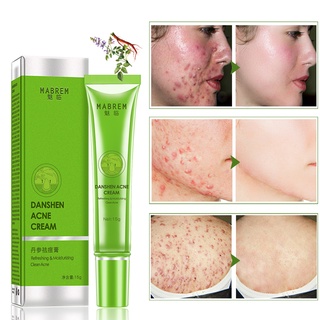 [jm]15g crema de eliminación de acné control de aceite poros retráctiles cuidado de la piel crema de eliminación de acné para la piel (1)