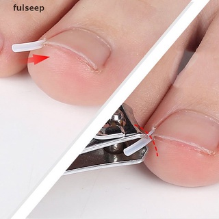 [fulseep] 10 piezas de pinza de enderezamiento de uñas encarnada para corrección de uñas, parche para uñas sdgc