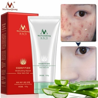 Moisturizing Repair Aloe Vera Gel Plant Extracts Ance Treatment Mild Soothing