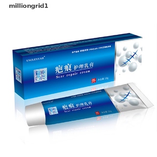 [milliongrid1] crema de eliminación de cicatrices de acné espinillas gel facial eliminar acné suavizante caliente (3)