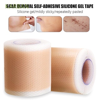 KARBAN Safe Silicone Gel Tape Efficient Therapy Patch Removal Scar Tape for Acne Trauma Burn Treatment Tape Surgery Self-Adhesive Easy to use Ear Correction Tape Skin Repair Tools