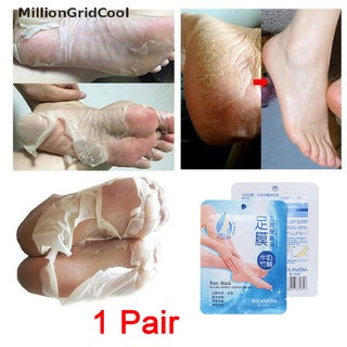 MillionGridCool 1 Pair Exfoliating Foot Masks Peeling Mask Remove Feet Dead Skin Calluses MGL