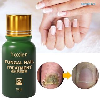 sevenfire 10ml solución de uñas eficaz anti infección sin dolor uñas tratamiento de renovación de hongos cuidado del pie