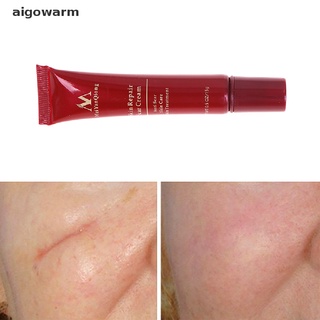 aigowarm scars removedor de cuidado de la piel crema cicatriz cirugía cortes de acné quemaduras estrías marcas co (5)