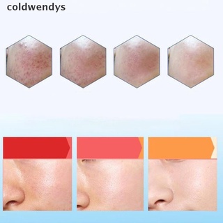 [coldwendys] 1set egf freeze dry polvo reparación suero anti envejecimiento antiarrugas disipar el acné