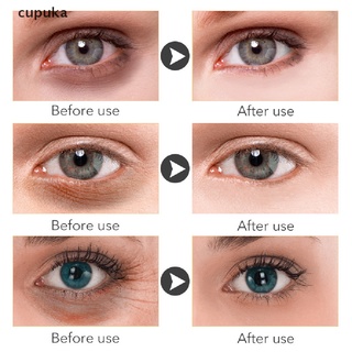 cupuka retinol crema de ojos crema de ojos levantamiento anti envejecimiento anti ojos bolsas eliminar arrugas co