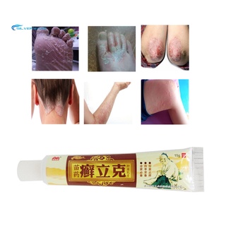 stock tratamiento de la piel tradicional chino herbal antibacteriano crema psoriasis ungüento (1)