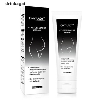[Drinka] OMY LADY Remove Pregnancy Scars Acne Cream Stretch Mark Repair Body Cream 471CO