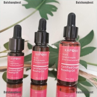 [bsb] aceite de rosa mosqueta certificado de piel orgánica aceite esencial puro y natural mejor aceite facial [baishangbest] (1)