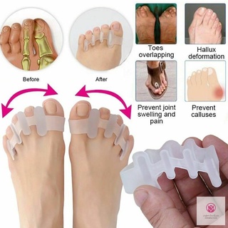2 pares separador del dedo del pie hallux valgus ortopédico del pulgar juanete superpuesto del dedo del pie corrector cuidado del pie