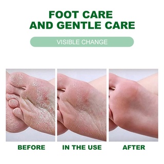 crema de tratamiento de pies exfoliante exfoliante exfoliante crema para el cuidado de los pies