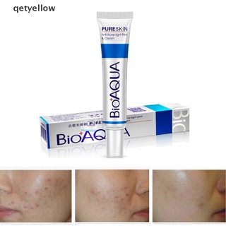 qetamarillo cuidado de la piel del acné retráctil cicatriz de poros eliminar el control de aceite hidratante crema facial co