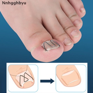 [nnhgghbyu] corrector de uñas de acero inoxidable para enderezar las uñas clip corrector de armadura venta caliente