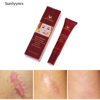 [sxm] removedor de cicatrices crema para el cuidado de la piel cirugía de cicatrices cortes de acné quemaduras manchas uyk