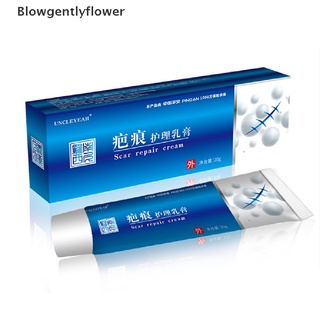 blowgentlyflower crema de eliminación de cicatrices de acné espinillas estrías gel cara eliminar acné suavizante bgf (3)