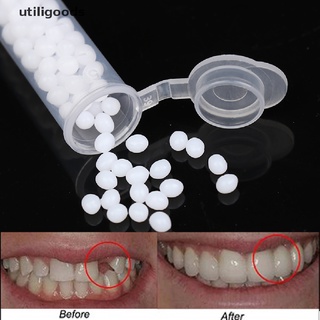 utiligoods kit de reparación temporal de dientes dientes y huecos dientes postizas pegamento sólido dientes dentadura venta caliente