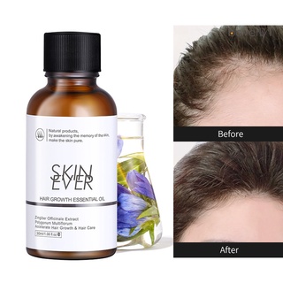 beverly1 - 30 ml aceites para el crecimiento del cabello, suavizante, nutritivo, cuidado del cabello, pérdida de cabello, tratamiento dañado seco, suero para el hogar