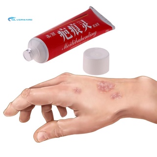 stock cicatriz eliminar decoloración eliminación antibacteriana ungüento cuerpo cara cuidado de la piel crema 60g