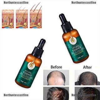 northvotescastfine productos de crecimiento del cabello para hombres mujeres natural aceite de jengibre suero crecer tratamiento rápido nvcf