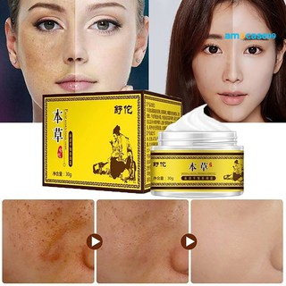 amocas crema facial 30g iluminador para remover manchas oscuras/tratamiento de melasma