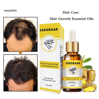 NOR| Lightweight Hair Growth Oils Health Care Beauty Dense Hair Growth Serum Prevent Boldness for Unisex (2)