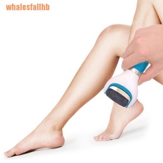 whalesfallhb cuidado de archivos de pie pies duro muerto eliminación de pies exfoliante talón pedicura dispositivo