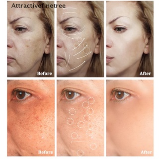 [aft] crema facial de caracol antiarrugas/crema hidratante de ácido hialurónico/crema para el envejecimiento de la cara