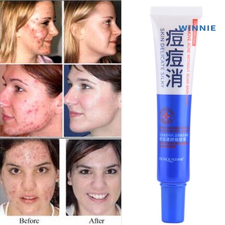 [winnie] bioaqua 30g acné comedo eliminación de espinillas retráctil poro hidratante crema para el cuidado de la piel (1)