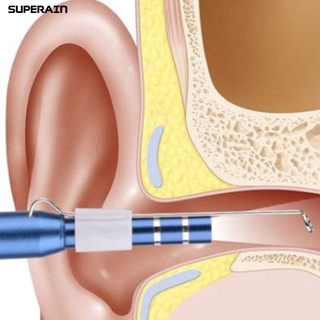 [Bodycare] 3.9 Mm Visual Earpick Acero Inoxidable Limpieza De Oído Multifuncional Otoscopio Para El Hogar (2)
