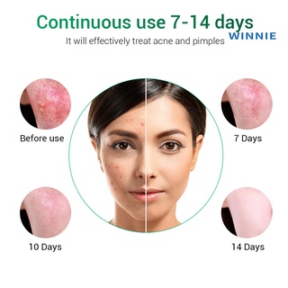 [winnie] breylee tratamiento del acné crema anti espinillas control de aceite de poros retráctiles gel reparador (6)