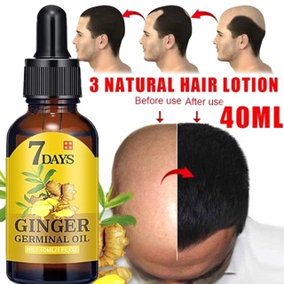 Regrow 7 días jengibre Germinal crecimiento del cabello suero peluquería tratamiento de pérdida de aceite (1)