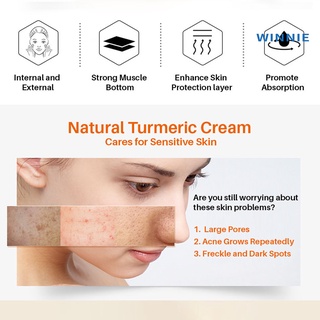 [Winnie] 30g Face Cream Skin Nourishing Whiten Acne Skin Care Moisturizers Repair Cream for Women (7)