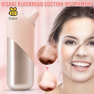 aspirador de puntos negros visibles removedor de puntos negros faciales herramienta de succión recargable de succión facial limpiador de poros
