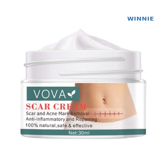 [winnie] 30 ml crema cicatrizante profundamente impregnada suavizar la cutícula cuidado de la piel acné estrías crema de eliminación para adultos (6)