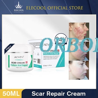 Listo stock ALIVER Reparación Cicatriz Crema Eliminar La Marca Estirable Scald Cesarean Bump Cirugía orbofire